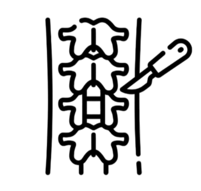 Minimally Invasive Spine Surgery